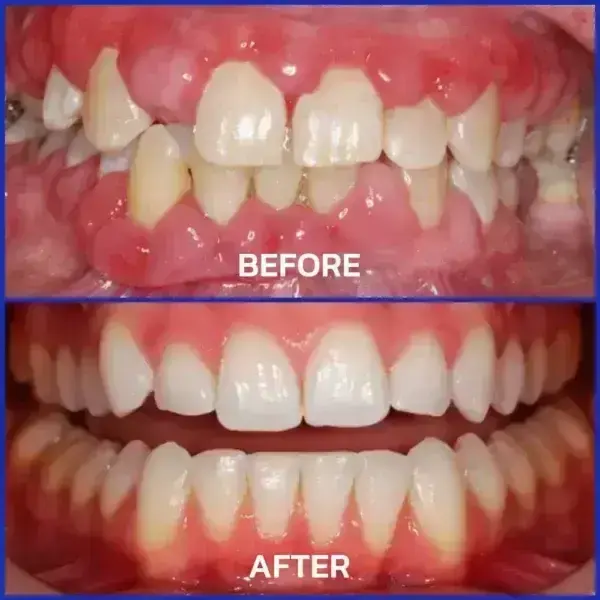 VioCore Bee Venom Dental Treatment Toothpaste - Image 6