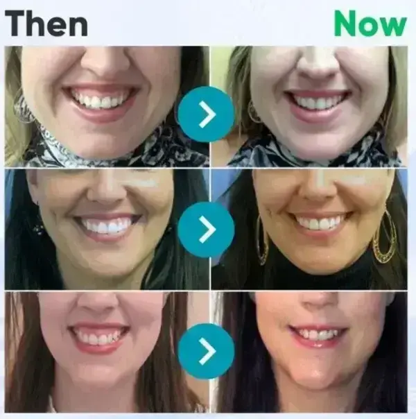 VioCore Bee Venom Dental Treatment Toothpaste - Image 8