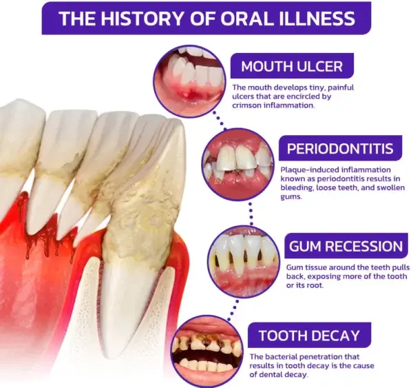VioGloss Bee Venom Dental Therapy Oral Power🦷 - Image 8