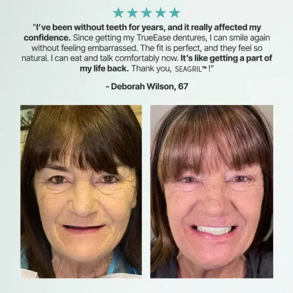 Custom-Fit Full Functional Dentures - Image 7