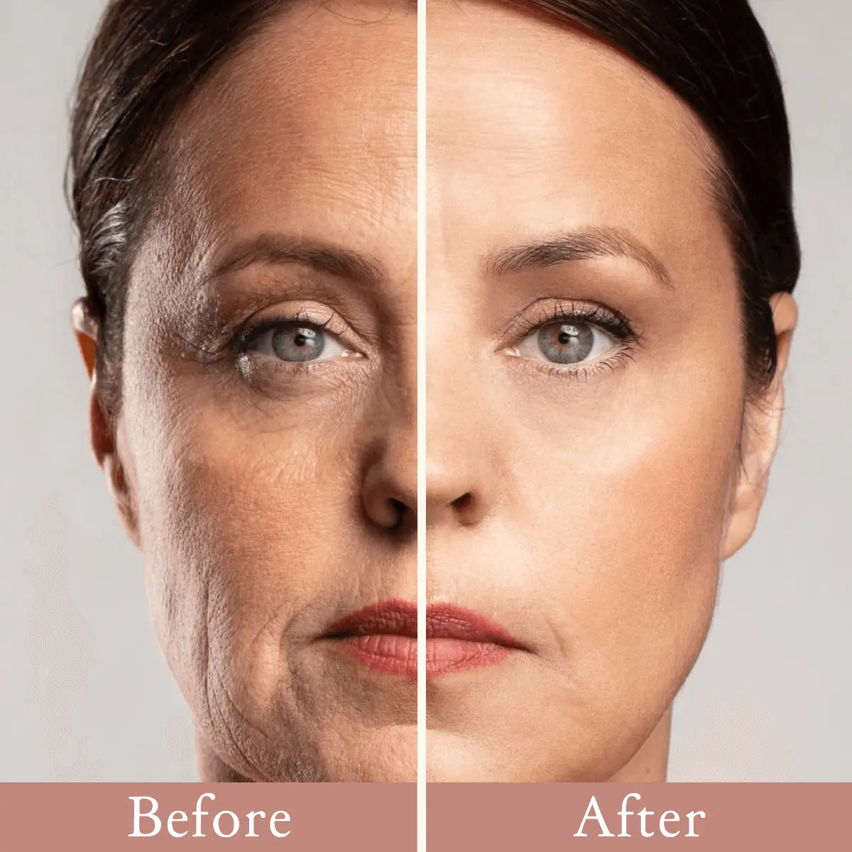 Eye Roller for Puffiness - Image 3