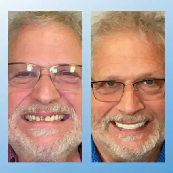 ๐๐๐ป๐ฐ๐๐ถ๐ผ๐ป๐ฎ๐น ๐ง๐ต๐ถ๐ฐ๐ธ๐ฒ๐ป๐ฒ๐ฑ ๐๐ฒ๐ป๐๐๐ฟ๐ฒ๐ - Image 5