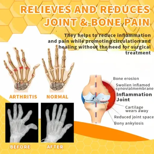 Bee Venom Joint Therapy Pain Relief Gel - Image 4