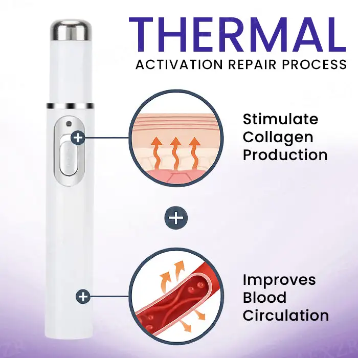 Laser Treatment - Image 3