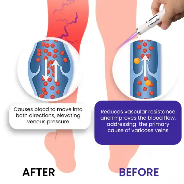 Laser Treatment - Image 7