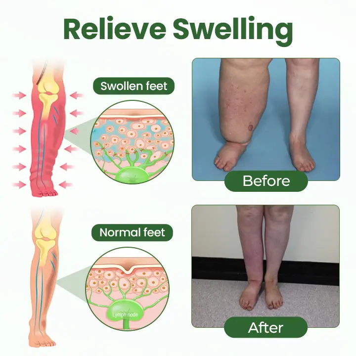 BodyRelief Circulation Cream - Image 8