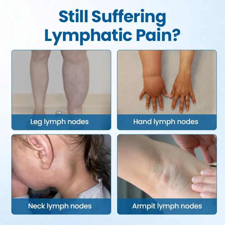 Lymphora Swelling Relief Roll-On - Image 9