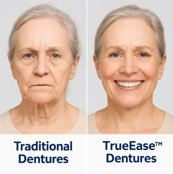 Full Dentures - Image 5