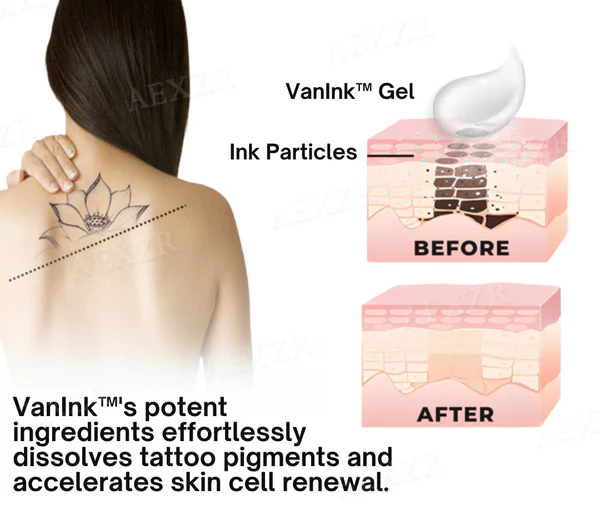 Tattoo Dissolving Gel - Image 10
