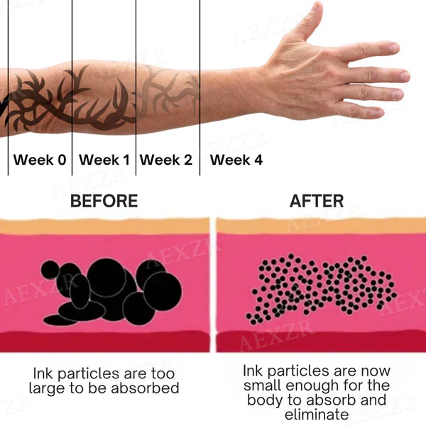 Tattoo Dissolving Gel - Image 9