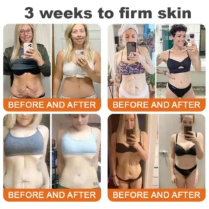 Alternative view of Winter Sale Botox Bee Venom Firming Serum Stick