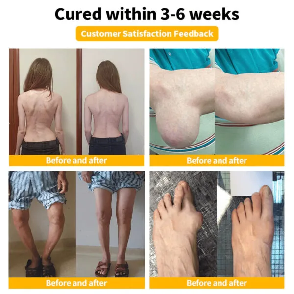 Bee Venom-Infused Relief for Bones - Image 8