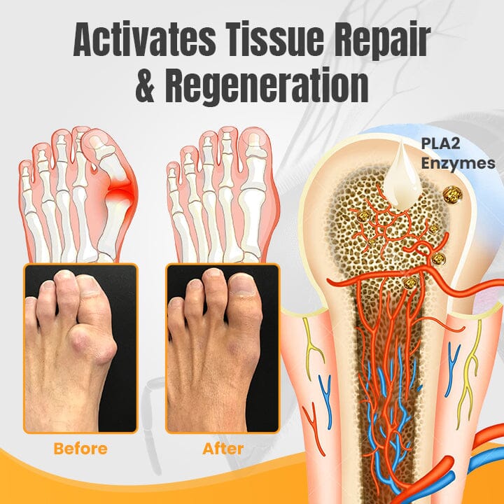 HalluxWell BeeVenom Therapy Cream - Image 7