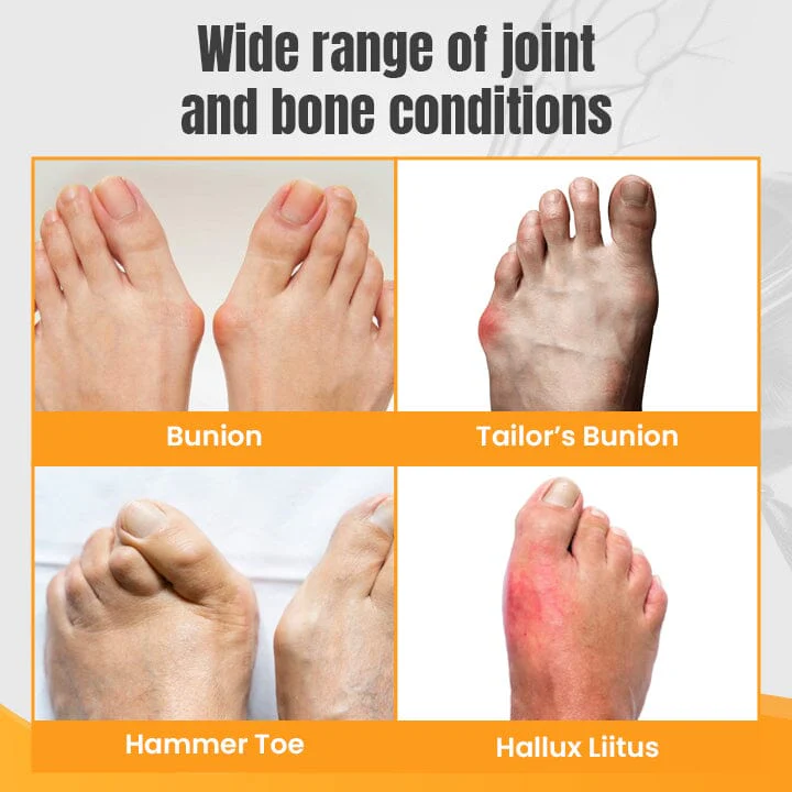 HalluxWell BeeVenom Therapy Cream - Image 5