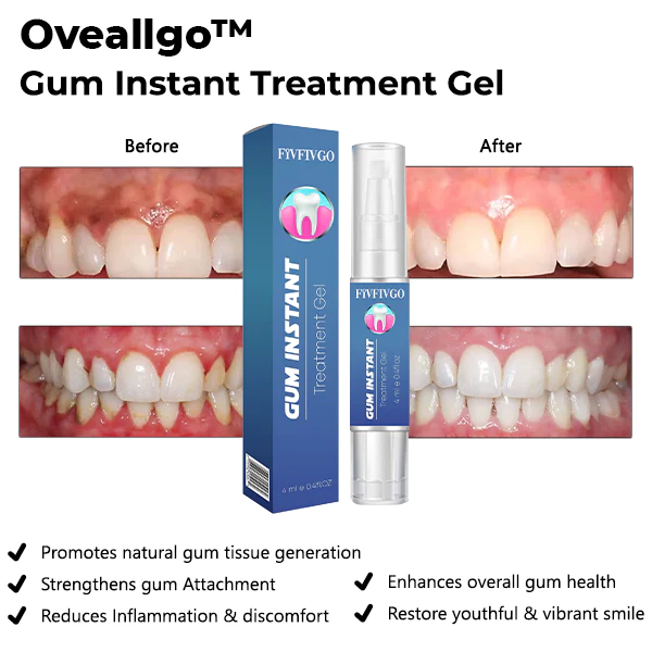 Gum Instant Treatment Gel - Image 4
