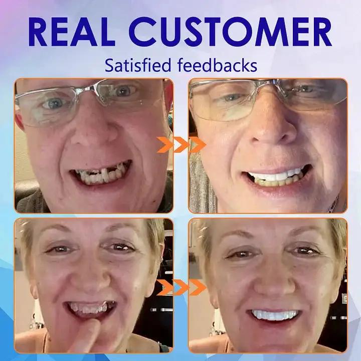 🦷Premium Advanced Customized Full Denture Set 💎 - Image 5