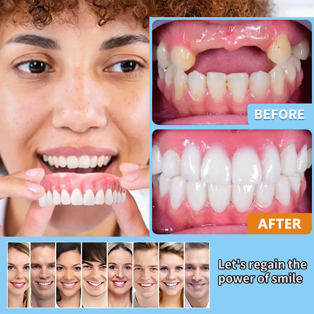 🦷Premium Advanced Customized Full Denture Set 💎 - Image 7
