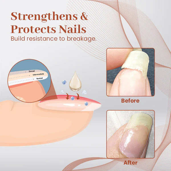Ultimate Nail Repair Serum - Image 4