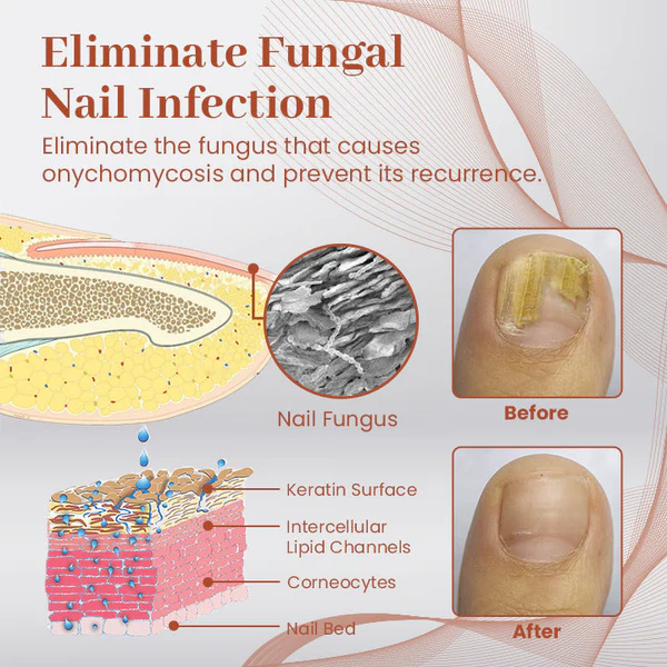 Ultimate Nail Repair Serum - Image 3
