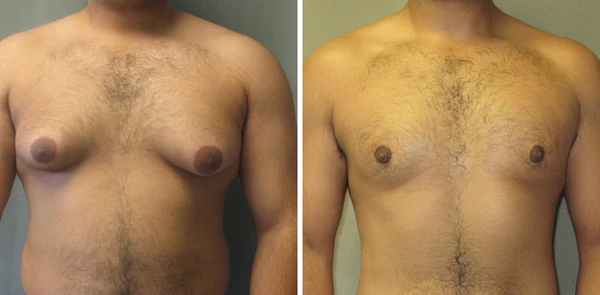 Shaper Hot Cream - Image 7