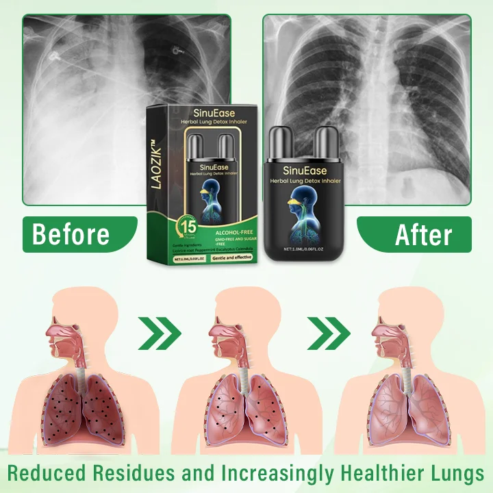 Herbal Lung Detox Inhaler - Image 6