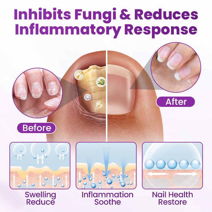 Foot Defense Mist - Image 8