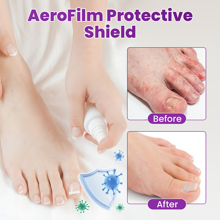 Foot Defense Mist - Image 7