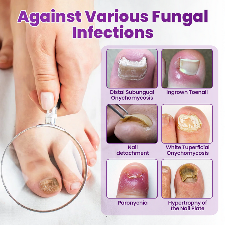 Foot Defense Mist - Image 6