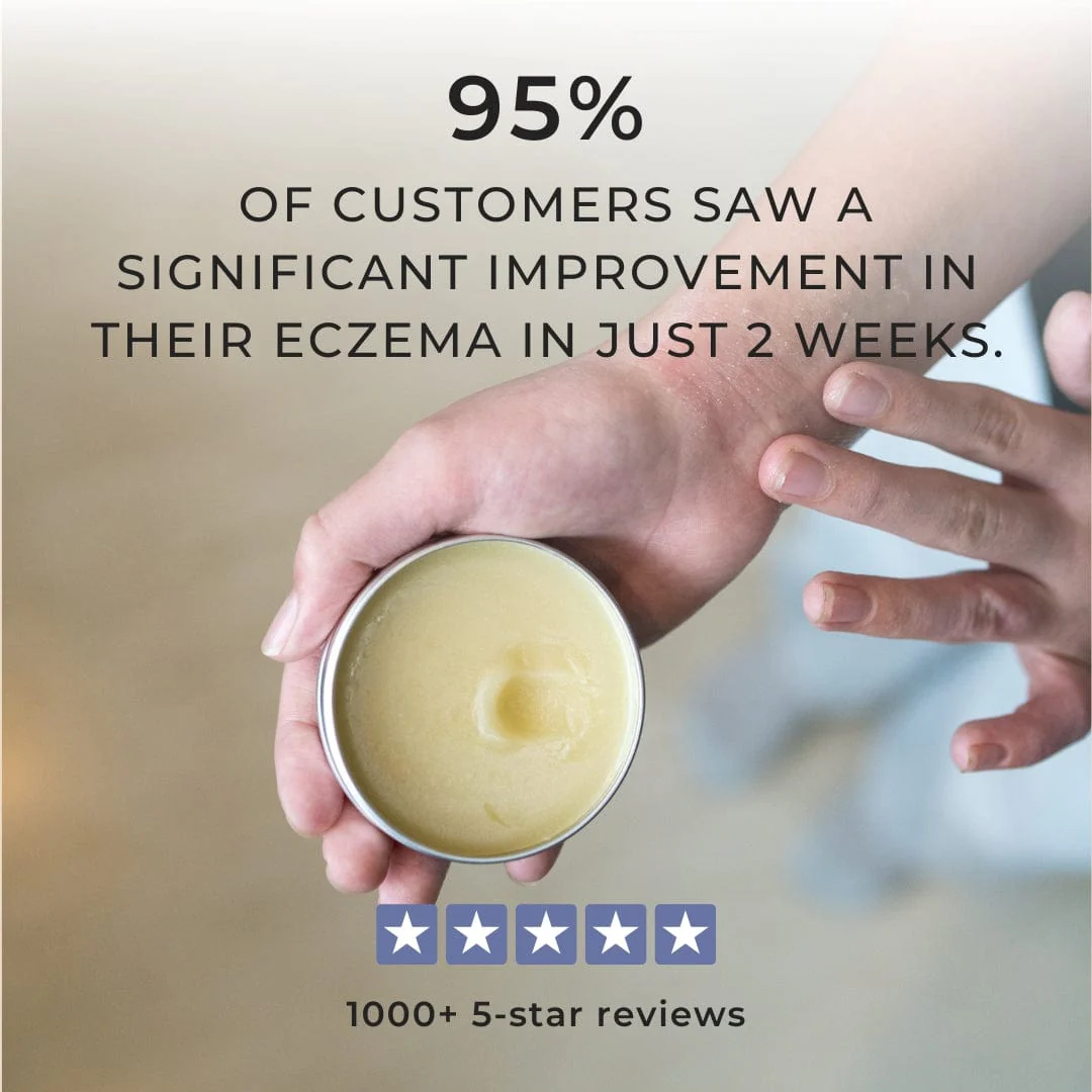 Miracle Manuka Skin Repair Balm - 100g - Image 3