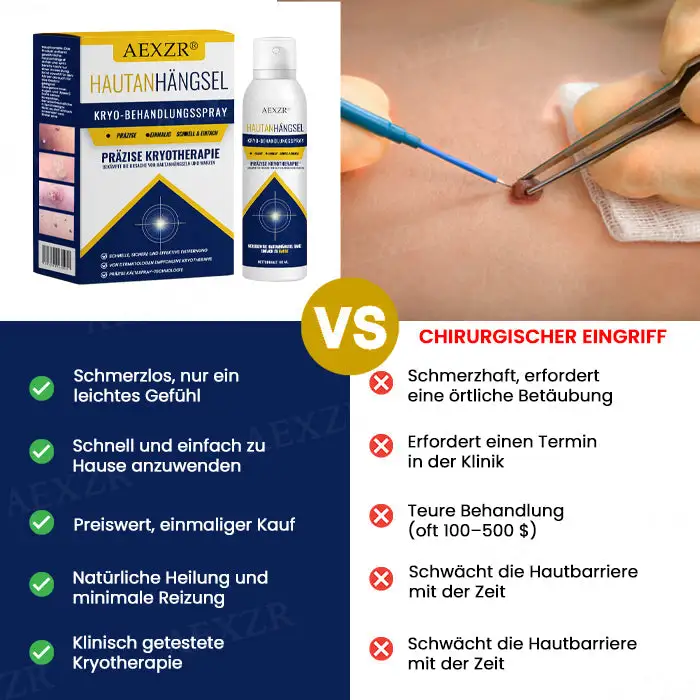 Kryo-Behandlungsspray - Image 2