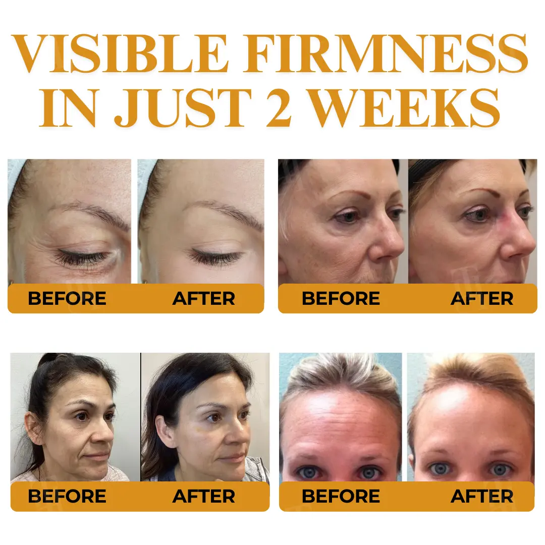 Letybo Bee Venom Wrinkle Removal Cream - Image 3