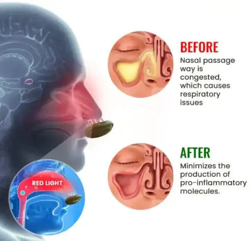 Respiratory Relief Light Therapy - Image 5