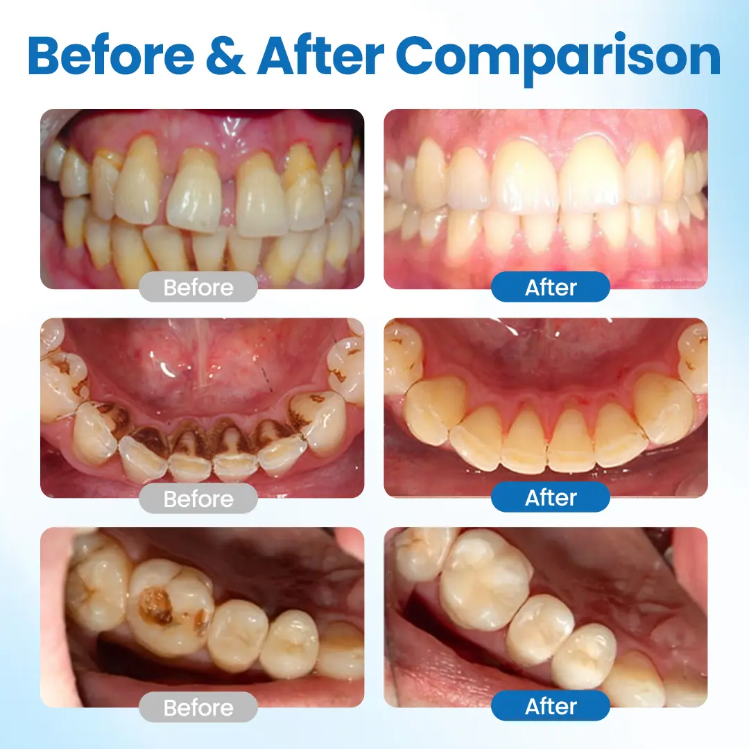 Tooth Defense Serum - Image 7