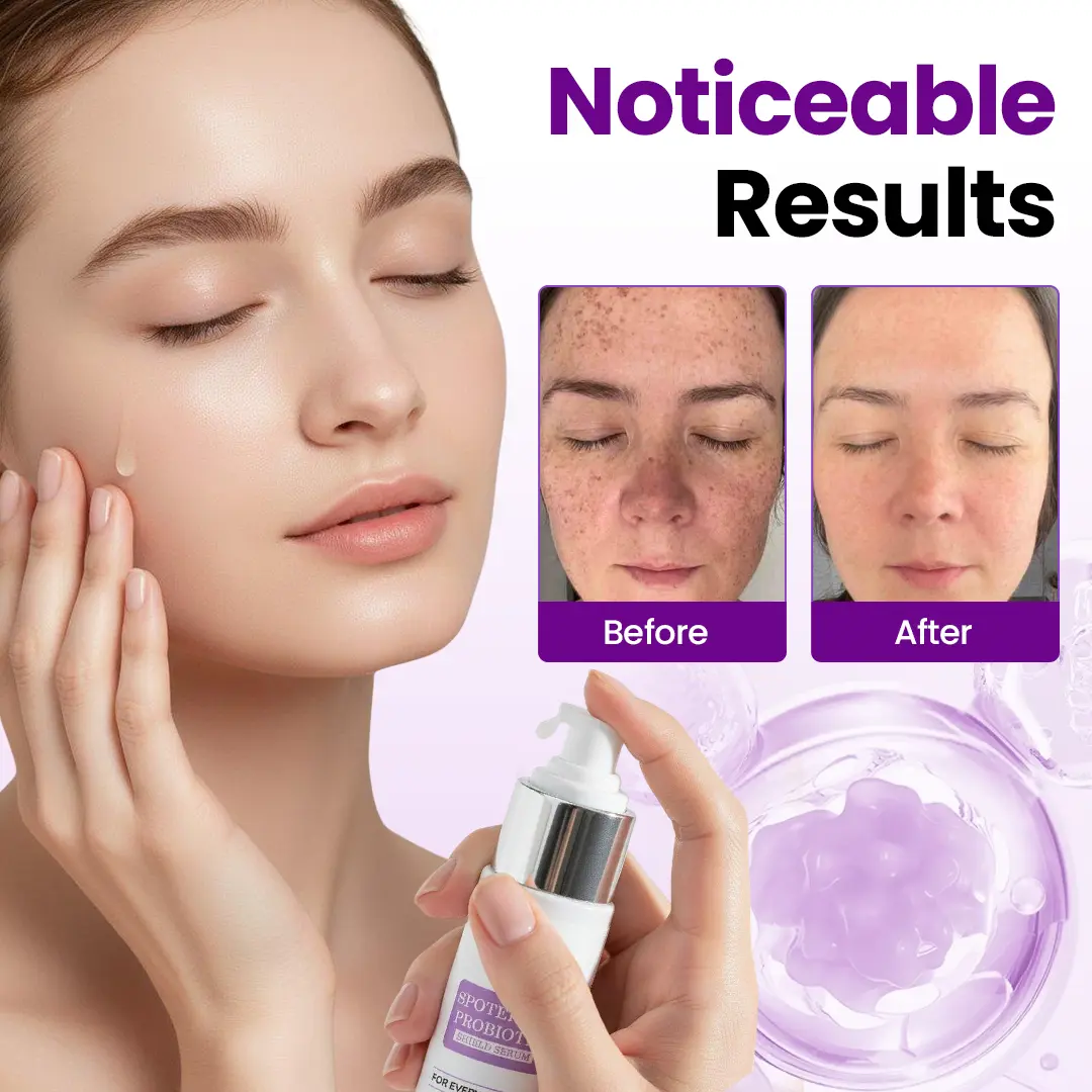 Probiotic Shield Serum - Image 4