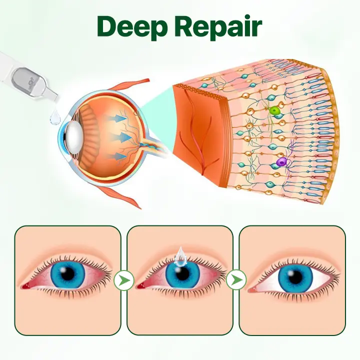 Vision Enhancing Multifunctional Eye Drops - Image 3