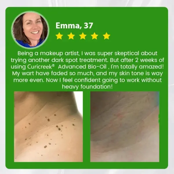 Advanced Pro Bio-Oil Mole & Spot Corrector Enhanced with Alligator Oil - Image 8