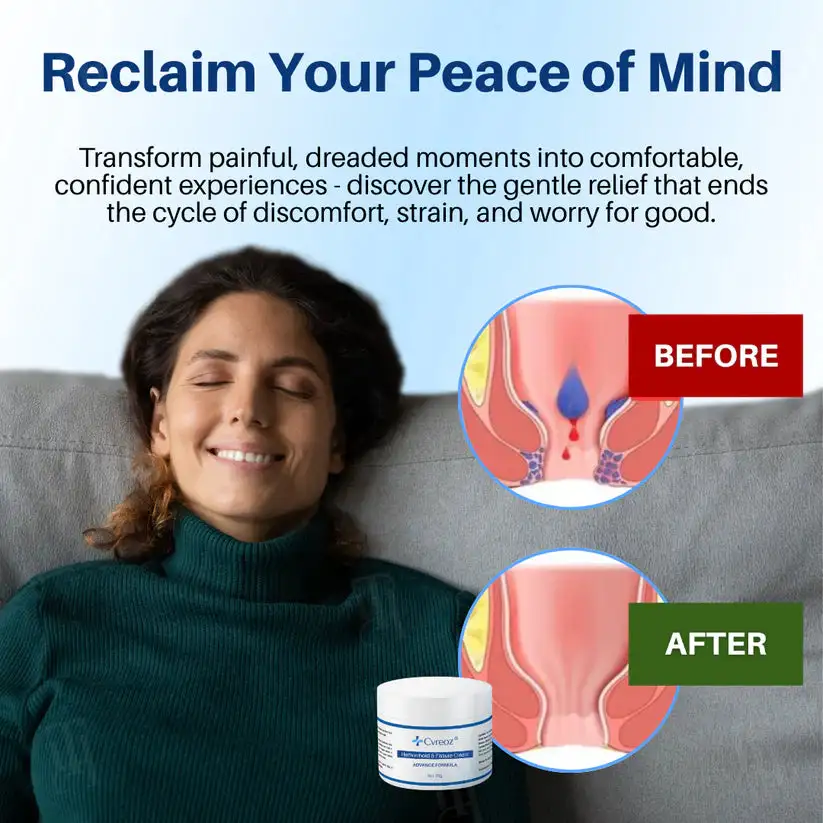 Hemorrhoid & Fissure Cream - Image 5