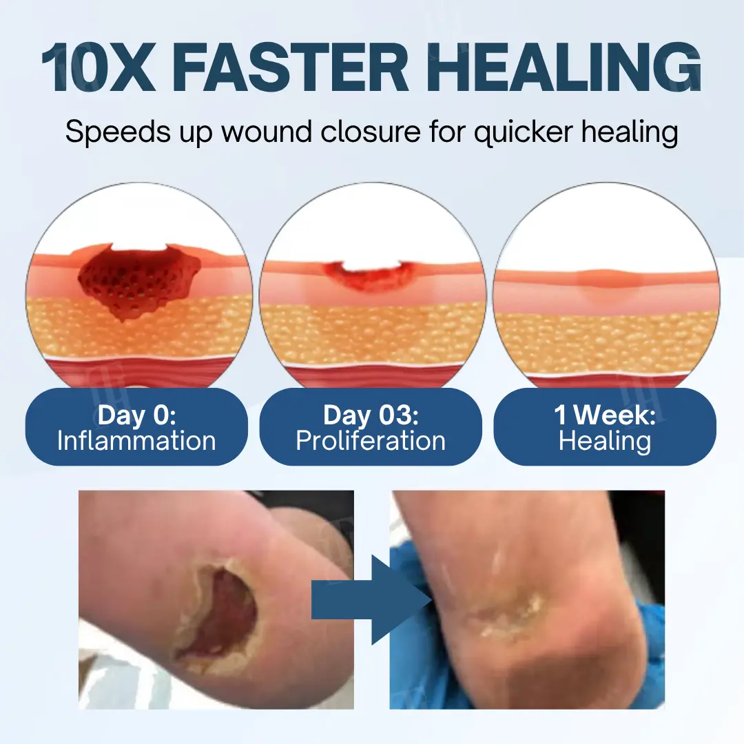 Ulcer-Relief Diabetes Treatment Cream - Image 6