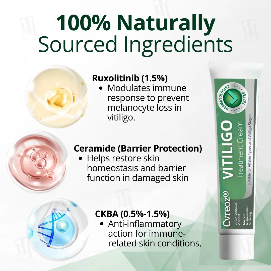Vitiligo Treatment Cream - Image 3