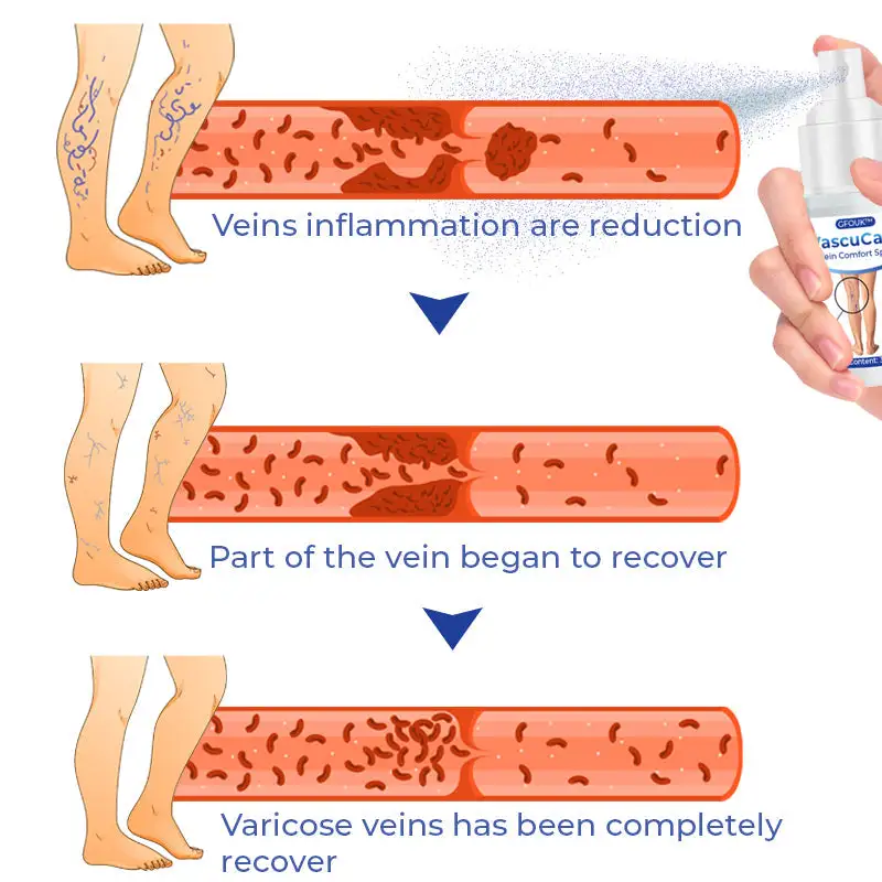 Vein Comfort Spray - Image 7