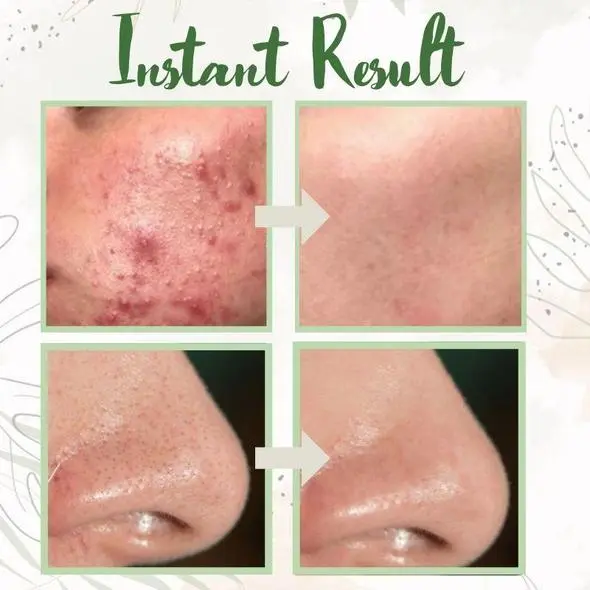 Green Tea Deep Cleanse Mask - Image 13