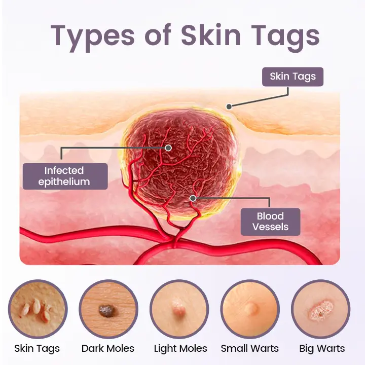 Wart Smooth Renewal Serum - Image 8