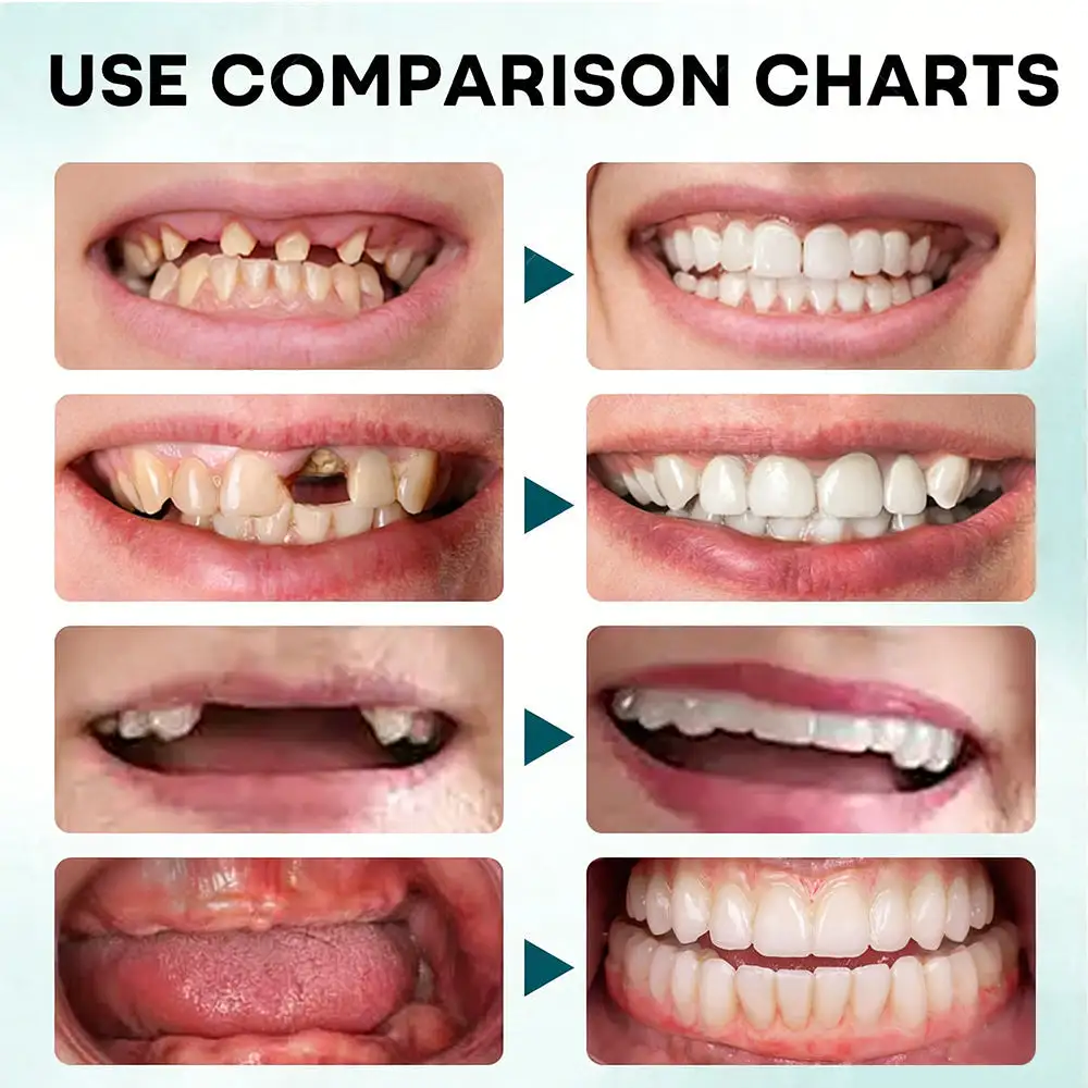 Denture Adhesive - Image 6