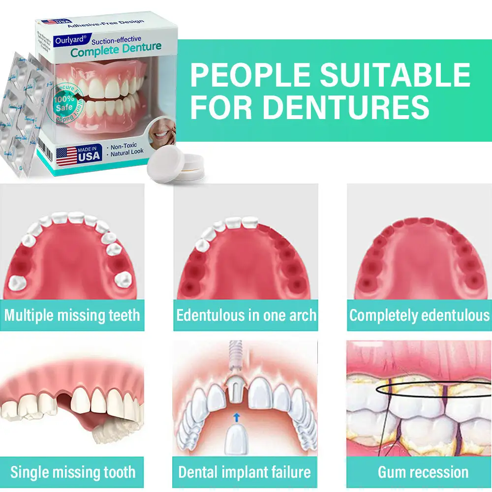 Suction-fit Complete Denture - Image 2