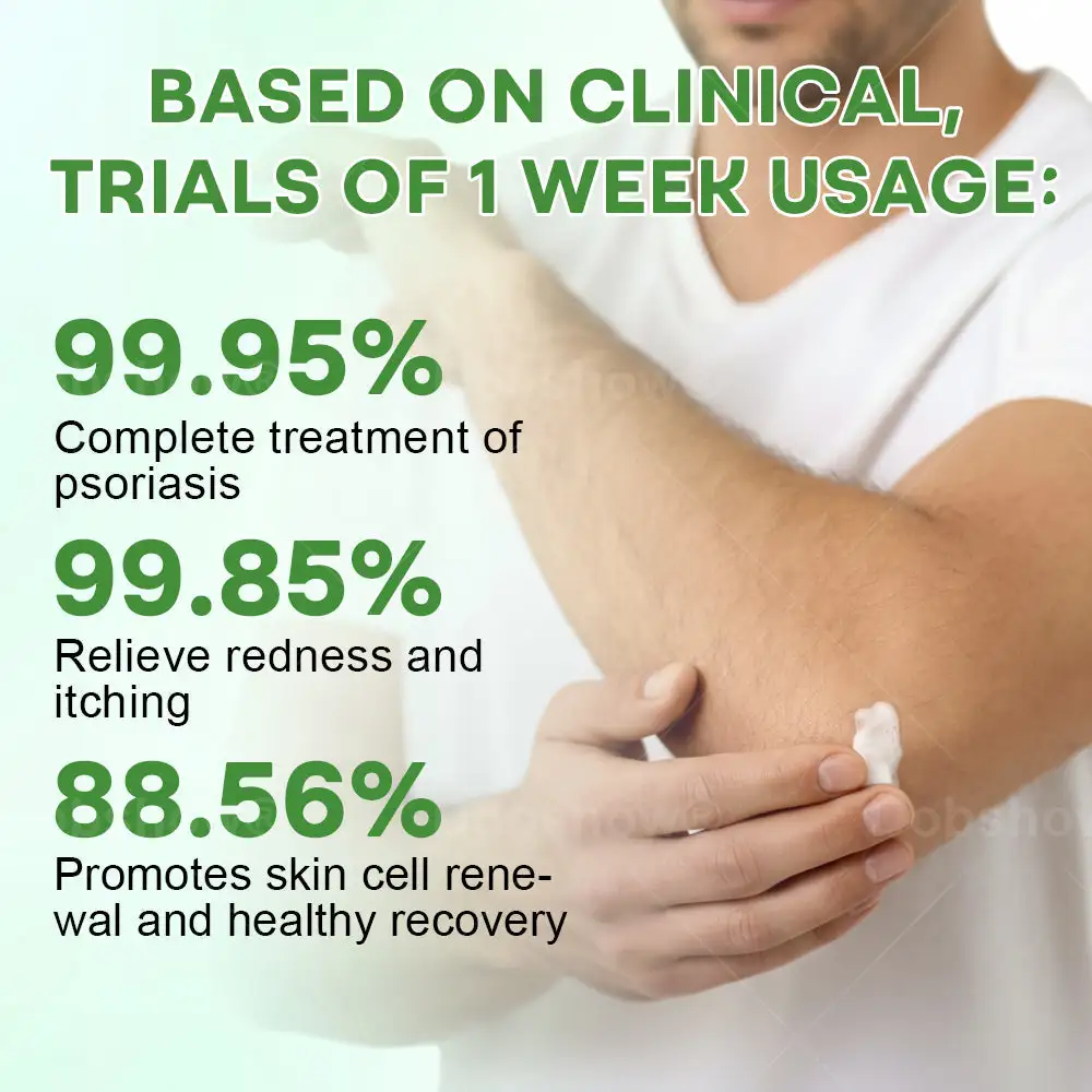 Herbal Psoriasis Relief Cream - Image 7