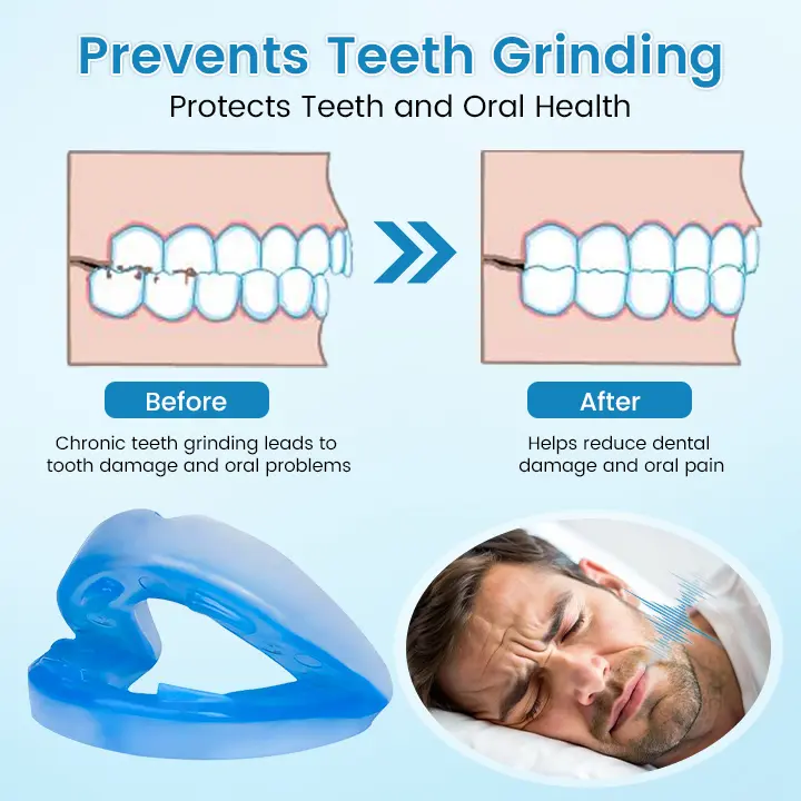 Sleep & Relax Breathing Protector – Dentist-Designed - Image 5