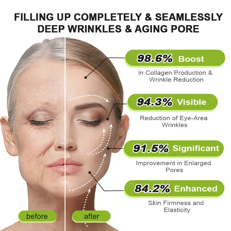 Botox & Vita-A Retinol Shot Wrinkle-Lift Tightening cream - Image 22