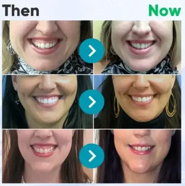 Bienengift-Zahntherapie Oral Power - Image 7