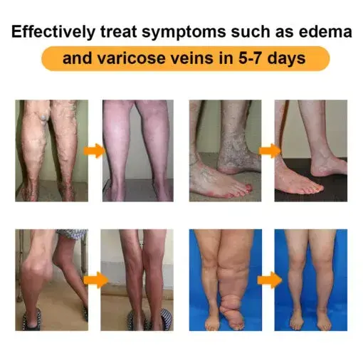 Joint & Bone Pain Foam Spray - Image 14