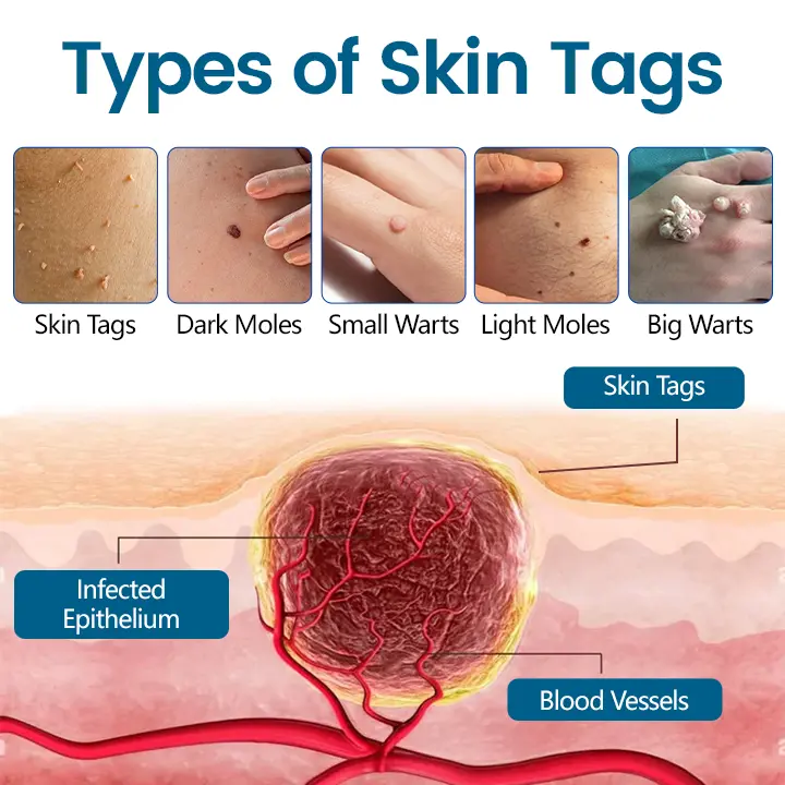 Precision Removal Cream - Image 8